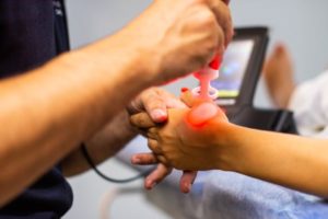 Tratamiento con láser de alta potencia en fisioterapia